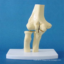 Human Elbow Joint Constitute Parts Skeleton Anatomy Model